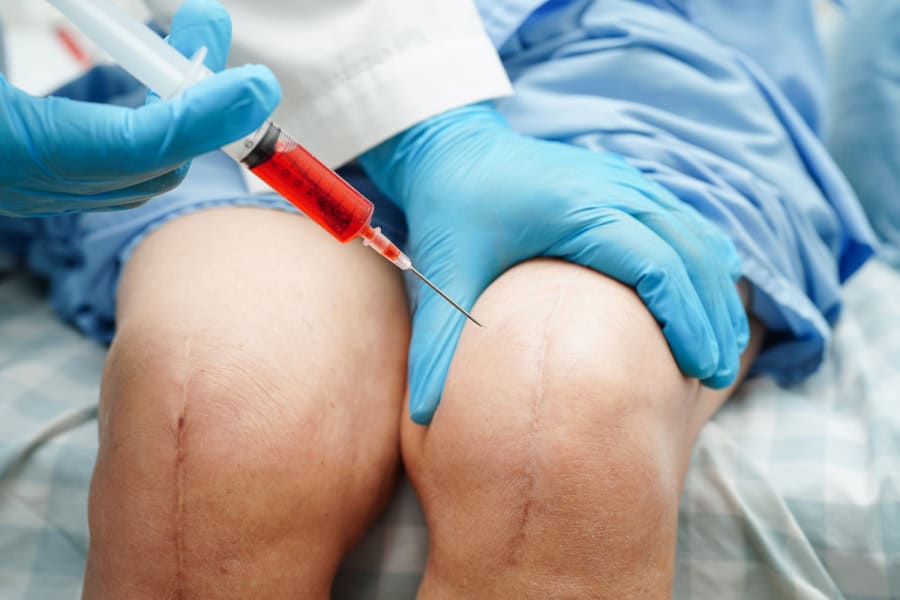 PRP Joint Injection in Chichester Mr Obakpunovwe