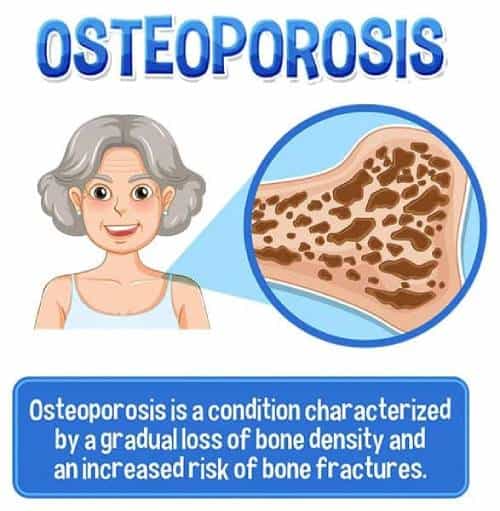 Osteoporosis